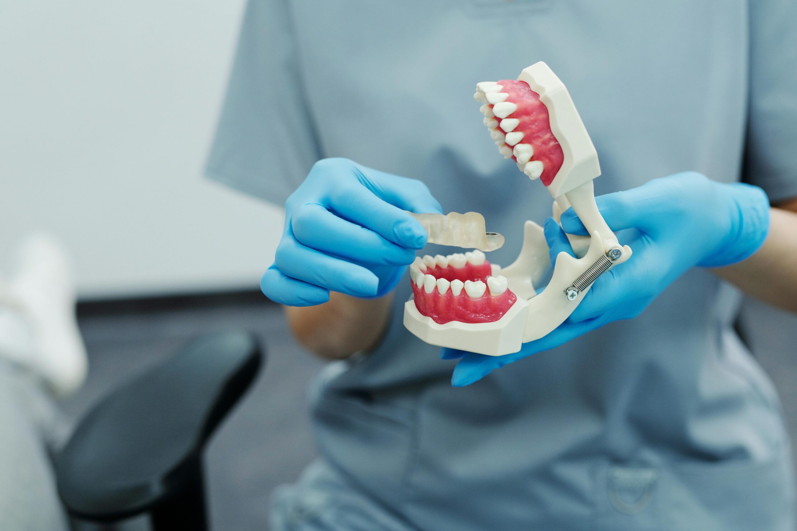 Dental Bonding Dallas TX